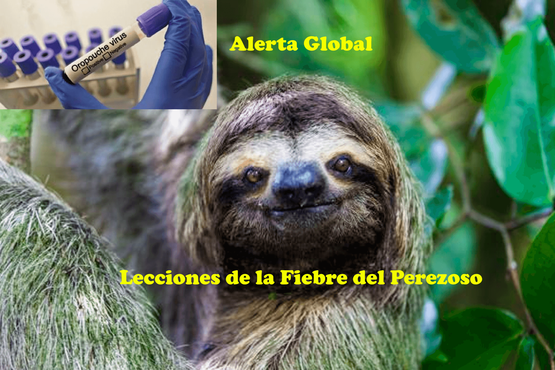 Lecciones cruciales de la fiebre del perezoso: La penúltima amenaza para la salud global.